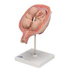 Twin Fetuses Model, 5th Month in Normal Position, 1000328 [L10/7], Pregnancy Models (Small)