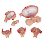 Serie 3B Scientific&reg; de Embarazo, 5 Modelos, 1018633 [L11/9], Modelos de Embarazo (Small)