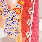 Model of Female Breast with Healthy & Unhealthy Tissue, 1008497 [L56], Breast Models (Small)