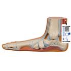 Модель плоской стопы - 3B Smart Anatomy, 1000355 [M31], Модели суставов, кисти и стопы человека