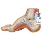 Fußmodell Hohlfuß (Pes cavus) - 3B Smart Anatomy, 1000356 [M32], Gelenkmodelle