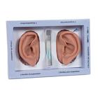 2 akupunktúrás fül, 1000373 [N15], Modellek