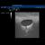 SONOtrain™ Breast model with cysts, 1019634 [P124], Ultrasound (Small)