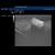 SONOtrain Ultraschall Brustmodell mit Tumoren, 1019635 [P125], Ultrasound Skill Trainers (Small)