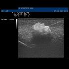SONOtrain&nbsp;Breast model with tumours, Light Skin, 1019635 [P125], Ultrasound Skill Trainers (Small)