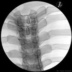 Image Guided Thoracic Spinal Injection Trainer P66, 1021899 [P66], Injections and Punctures (Small)