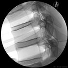 Image Guided Thoracic Spinal Injection Trainer P66, 1021899 [P66], Injections and Punctures (Small)