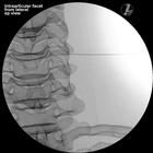 Image Guided Cervical Spine Injection Trainer P67, 1021900 [P67], Injections and Punctures (Small)