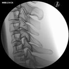 Image Guided Cervical Spine Injection Trainer P67, 1021900 [P67], Injections and Punctures (Small)