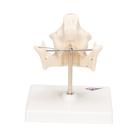 Milk Denture Model with Remaining Teeth, 1001248 [VE282], Dental Models (Small)