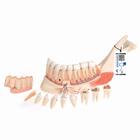Comprehensive Lower Jaw Model (Left Half) with Diseased Teeth, Nerves, Vessels & Glands, 19 part - 3B Smart Anatomy, 1001250 [VE290], Dental Models