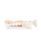 Comprehensive Lower Jaw Model (Left Half) with Diseased Teeth, Nerves, Vessels & Glands, 19 part, 1001250 [VE290], Dental Models (Small)