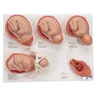 Doğum evreleri modeli - 3B Smart Anatomy, 1001259 [VG393], Gebelik Modelleri