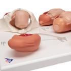 Labor Stages Model, Small, 1001259 [VG393], Pregnancy Models (Small)