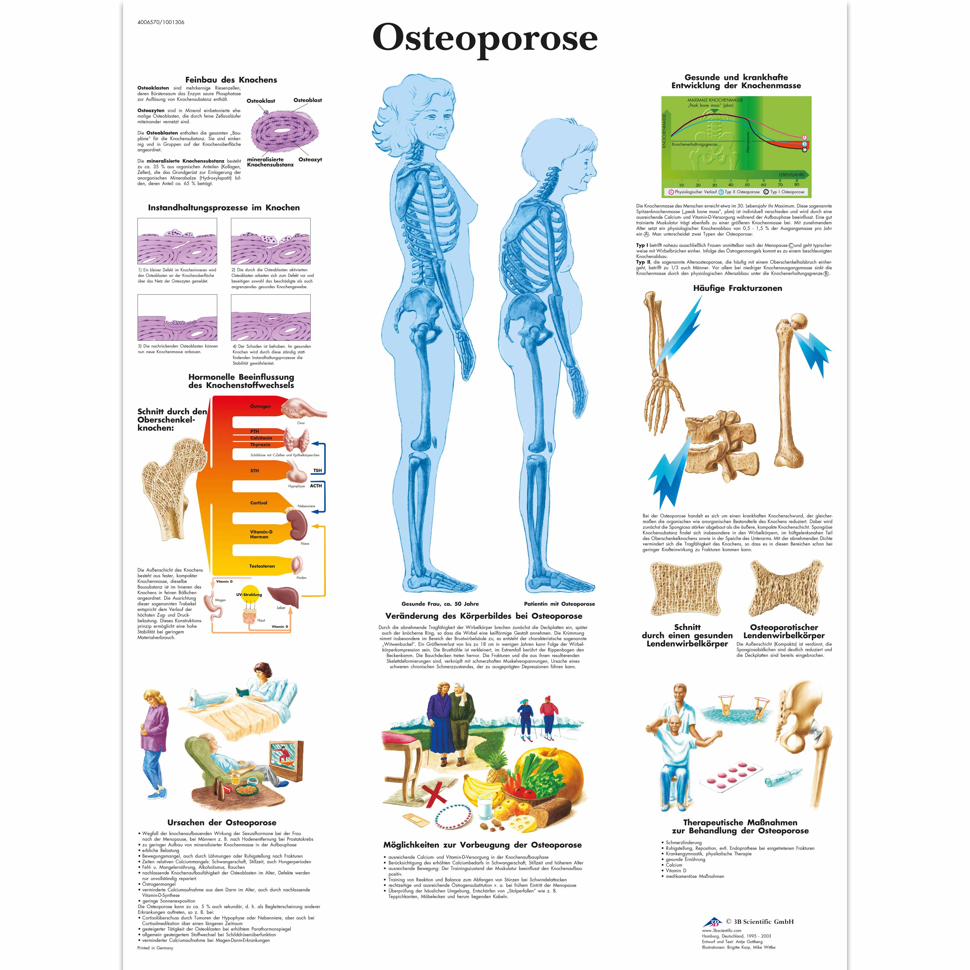 Osteoporose - 1001306 - VR0121L - Éducation Arthrite et ...