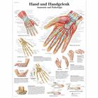 Lehrtafel - Hand und Handgelenk - Anatomie und Pathologie, 4006576 [VR0171UU], Skelettsystem