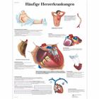Häufige Herzerkrankungen, 4006598 [VR0343UU], Cardiovascular System