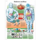 Lehrtafel - Diabetes melllitus, 1001391 [VR0441L], Stoffwechselsystem