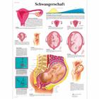 Lehrtafel - Schwangerschaft, 1001408 [VR0554L], Schwangerschaft und Geburt
