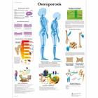Osteoporosis Chart, 4006653 [VR1121UU], Skeletal System