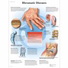 Rheumatic Diseases Chart, 1001476 [VR1124L], Skeletal System