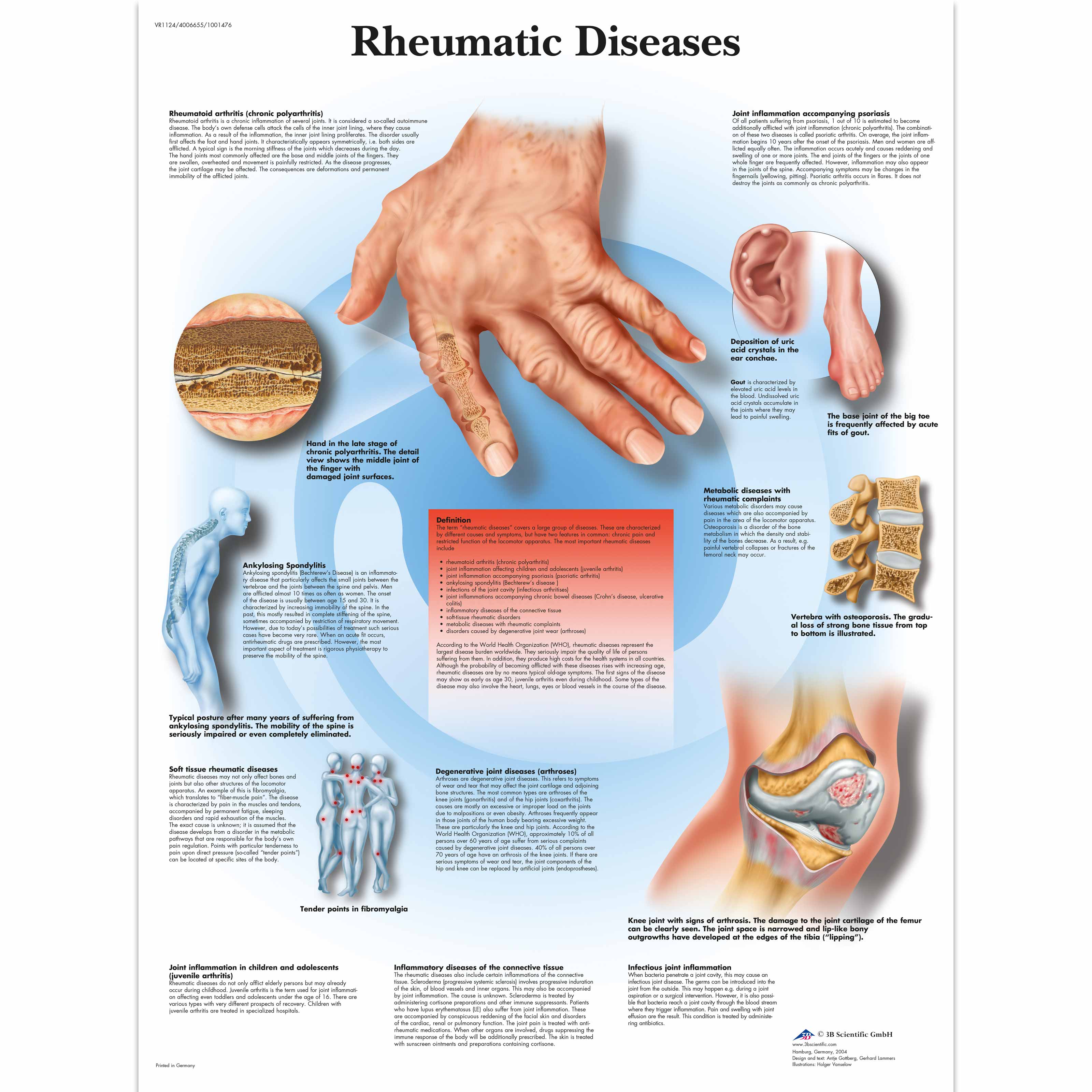 Gastroesophageal Disorders Anatomical Chart