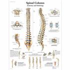Lehrtafel - Spinal Column - Anatomy and Pathology, 1001480 [VR1152L], Skelettsystem