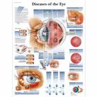 Pôster das Doenças do Olho, 1001498 [VR1231L], Olhos