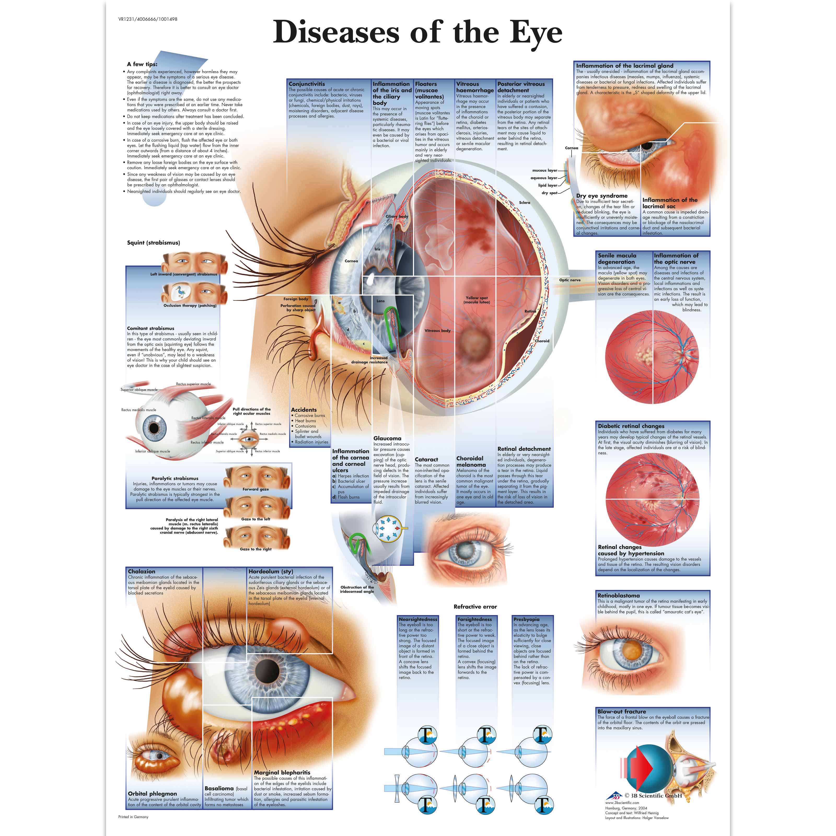 Eye Anatomy Chart