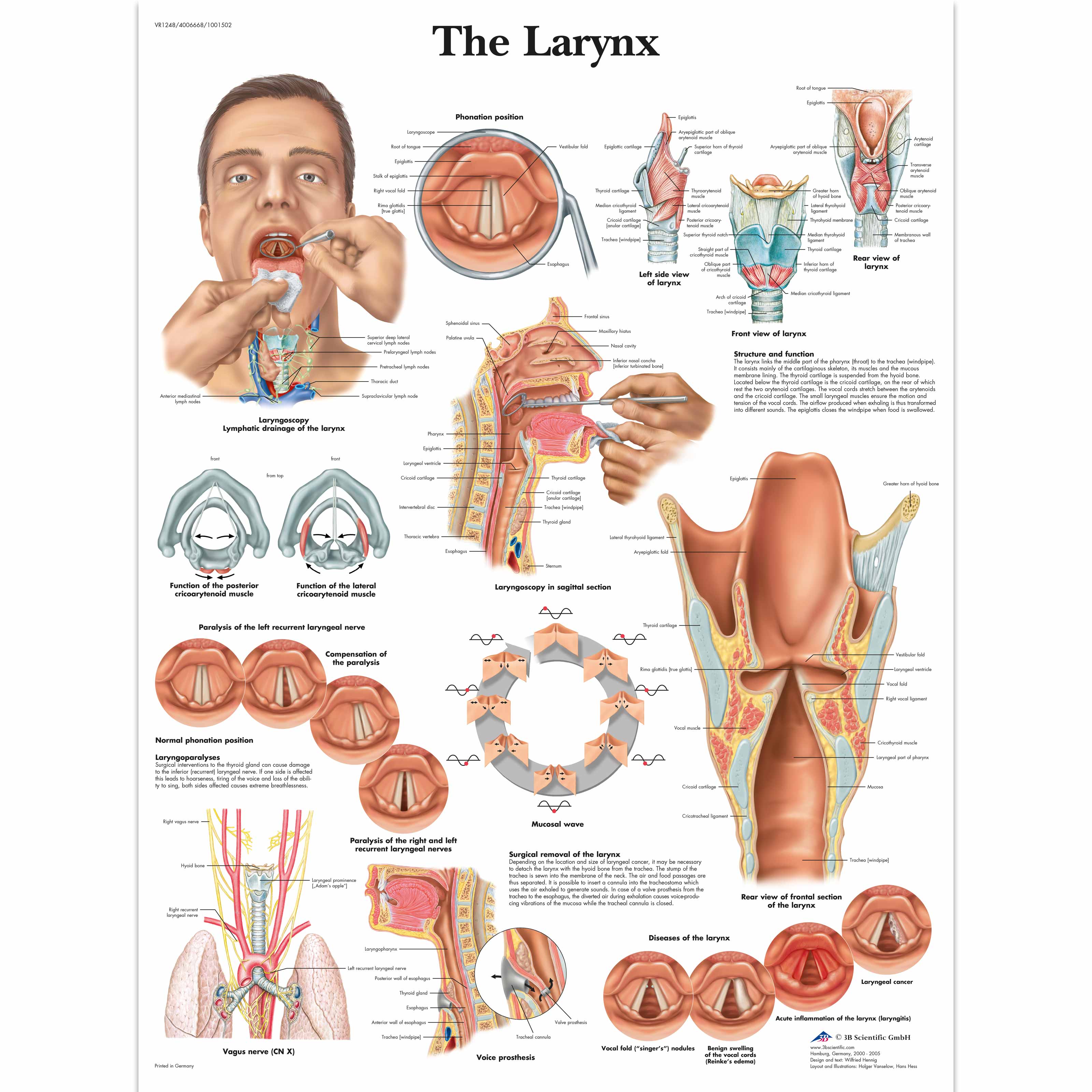 The Larynx Chart - 1001502 - VR1248L - Speech Organs - 3B ...
