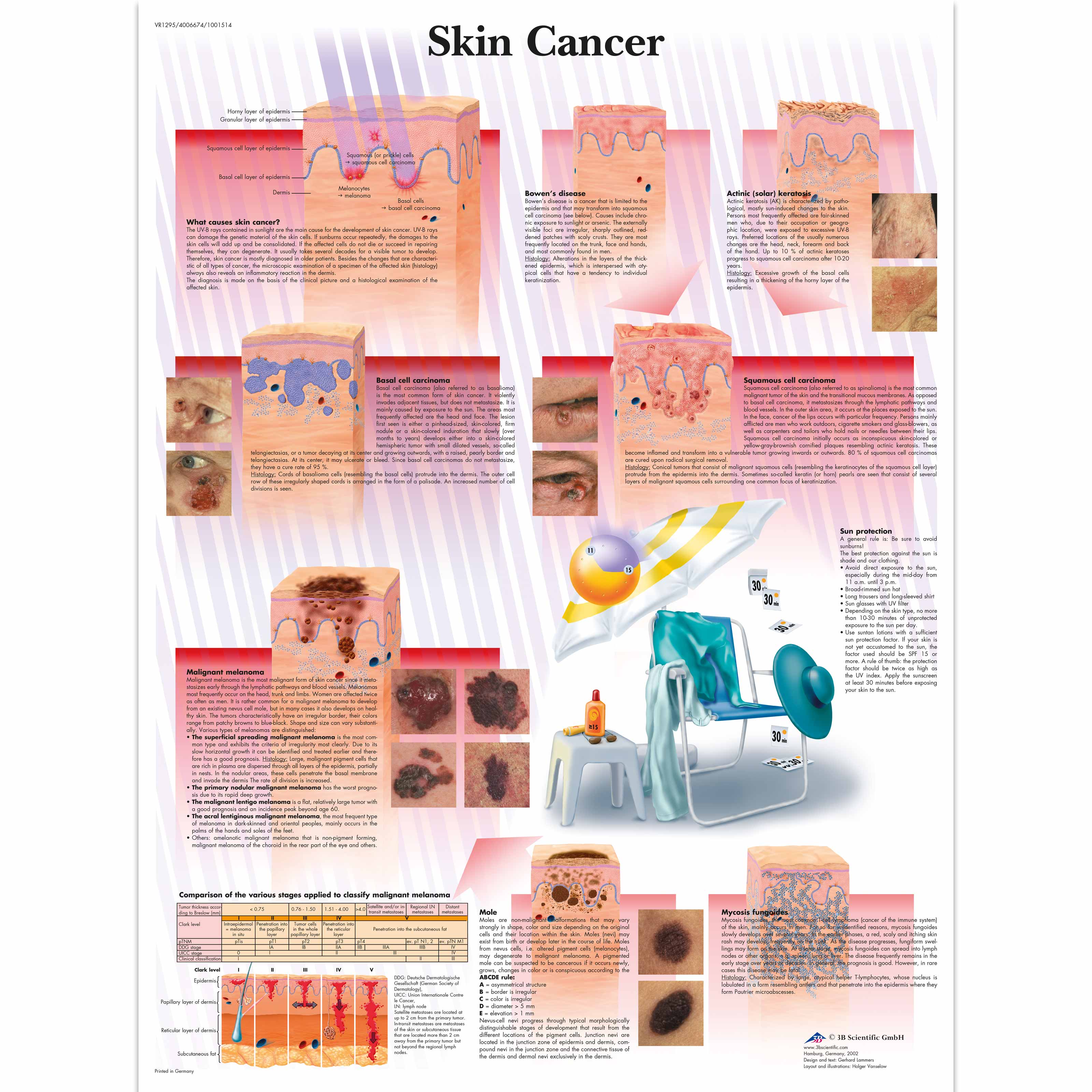 Skin Cancer Picture Chart