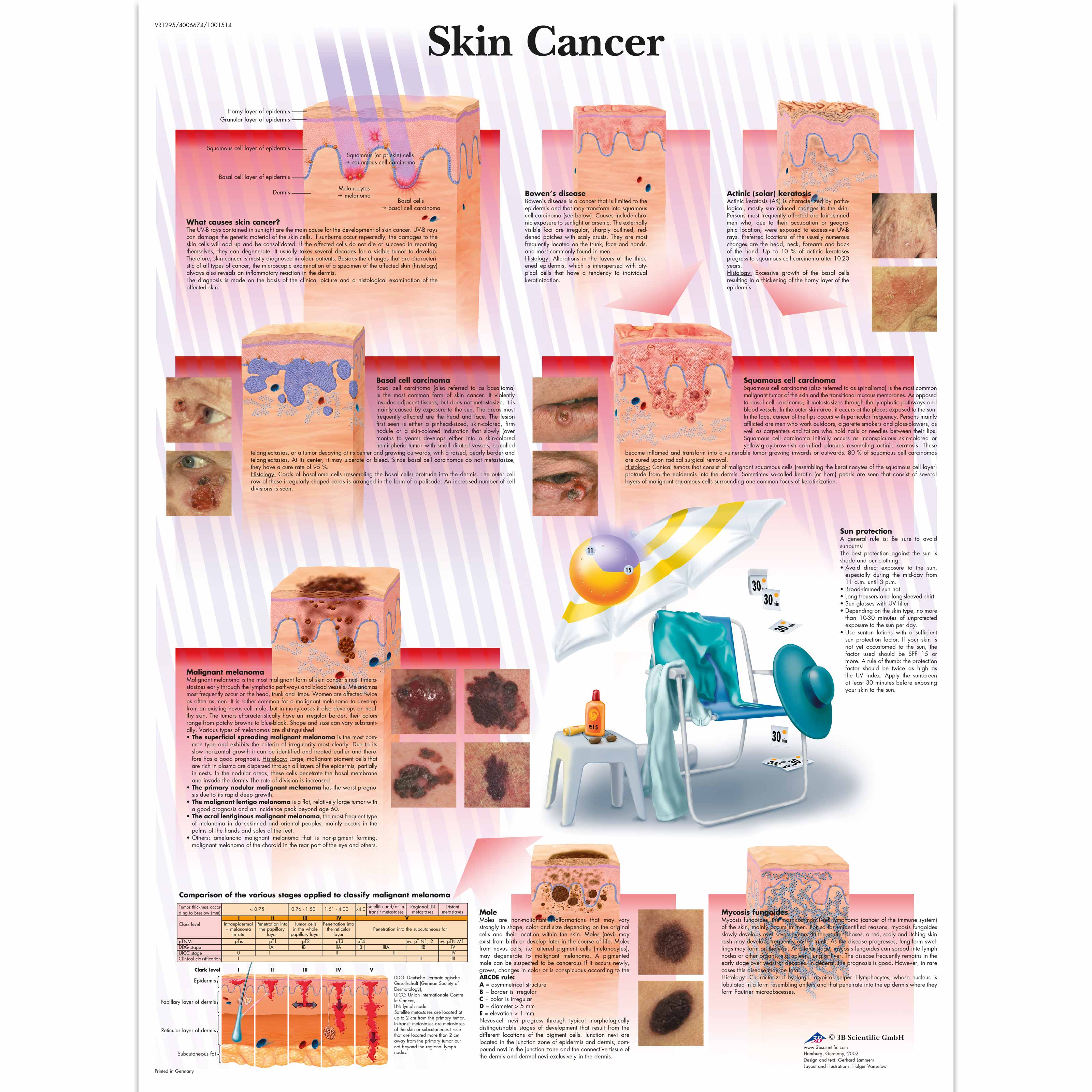 Skin Cancer Chart Pictures