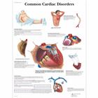 常见的心脏疾病挂图, 4006680 [VR1343UU], 心脏健康和身体健康教育示意图