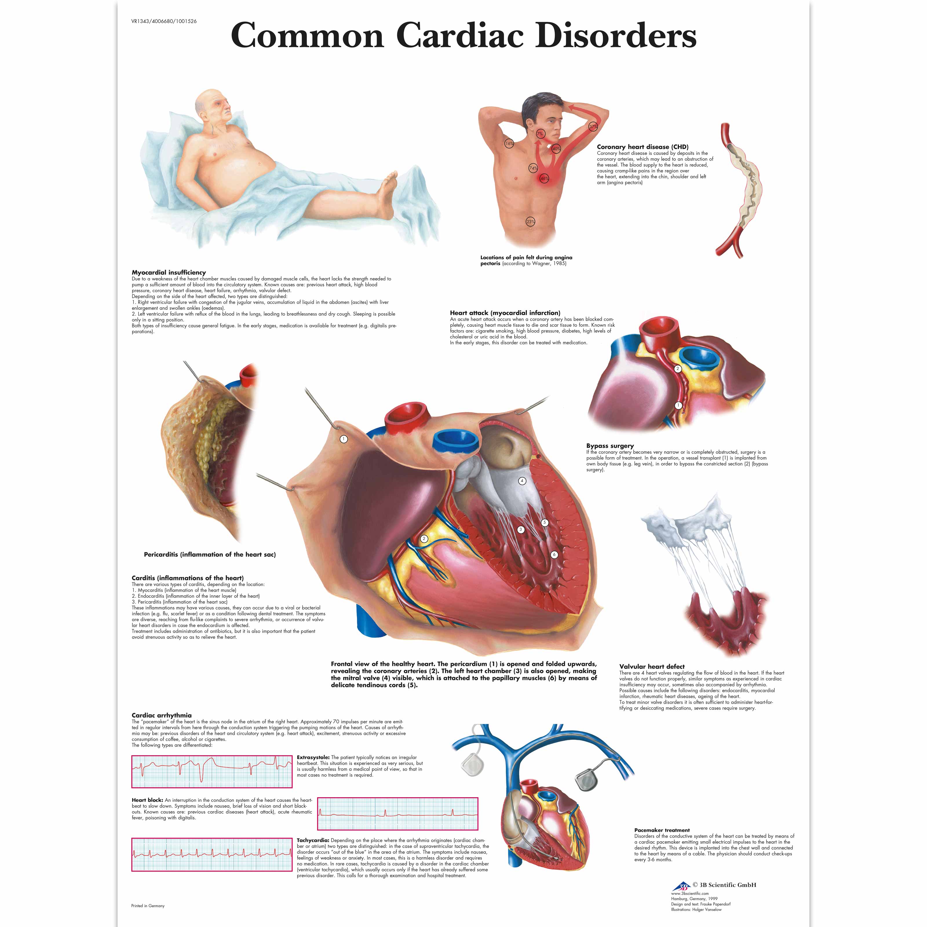 Cardiovascular System Chart