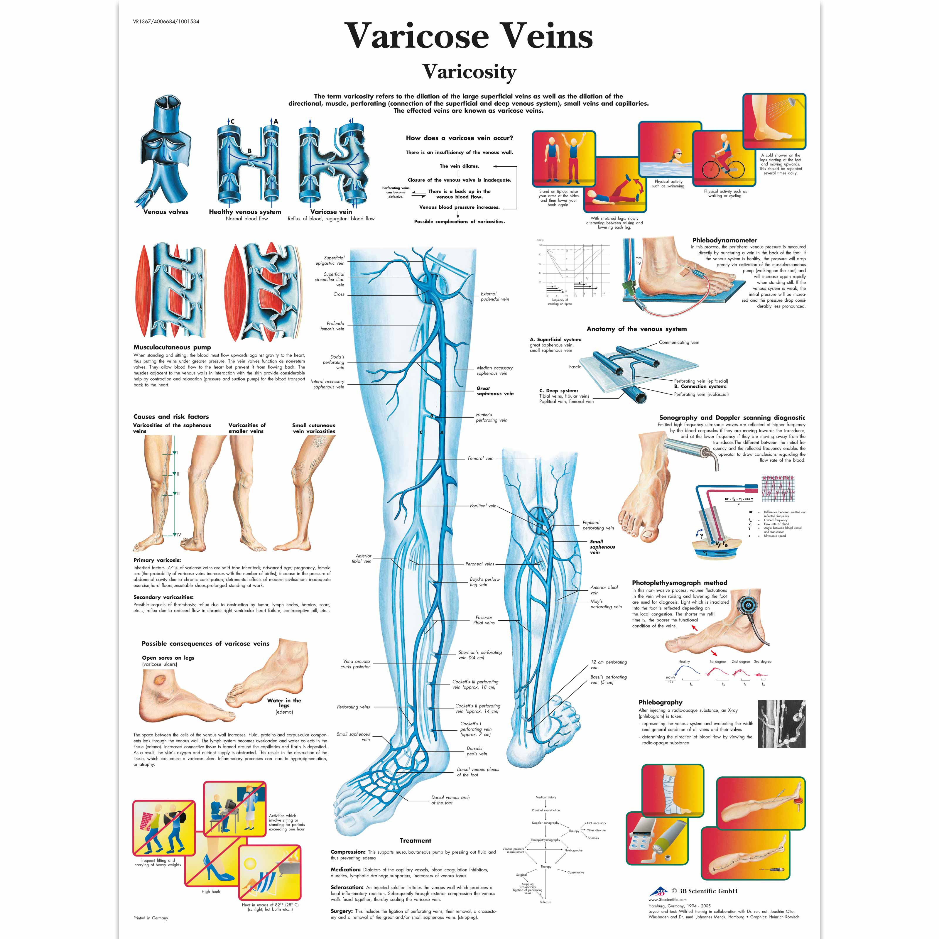 Vein Chart