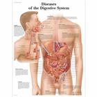 Pôster das Doenças do Sistema Digestivo, 1001548 [VR1431L], Sistema digestivo