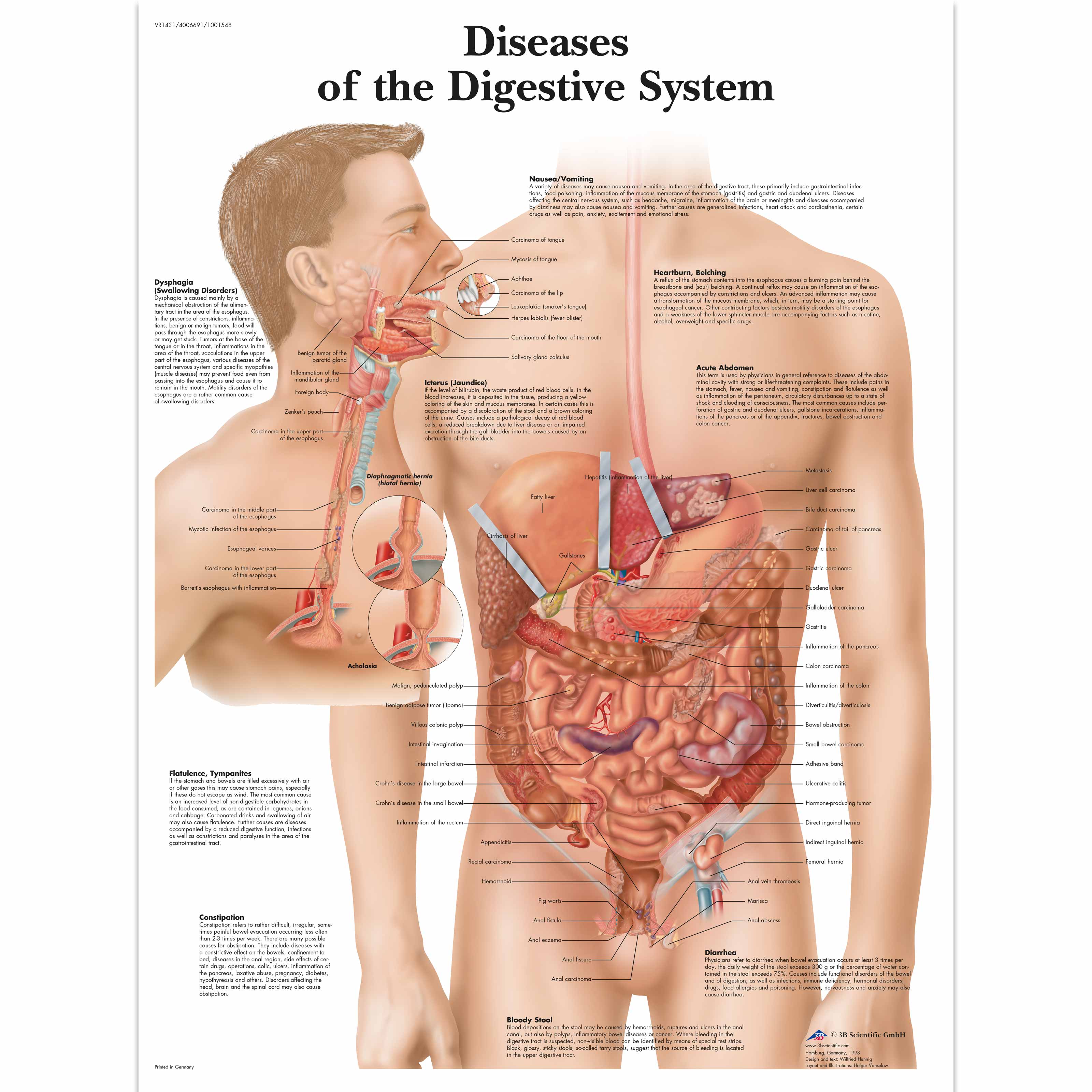 Gastroesophageal Disorders Anatomical Chart