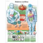 Diabetes Mellitus Chart, 1001554 [VR1441L], Metabolic System