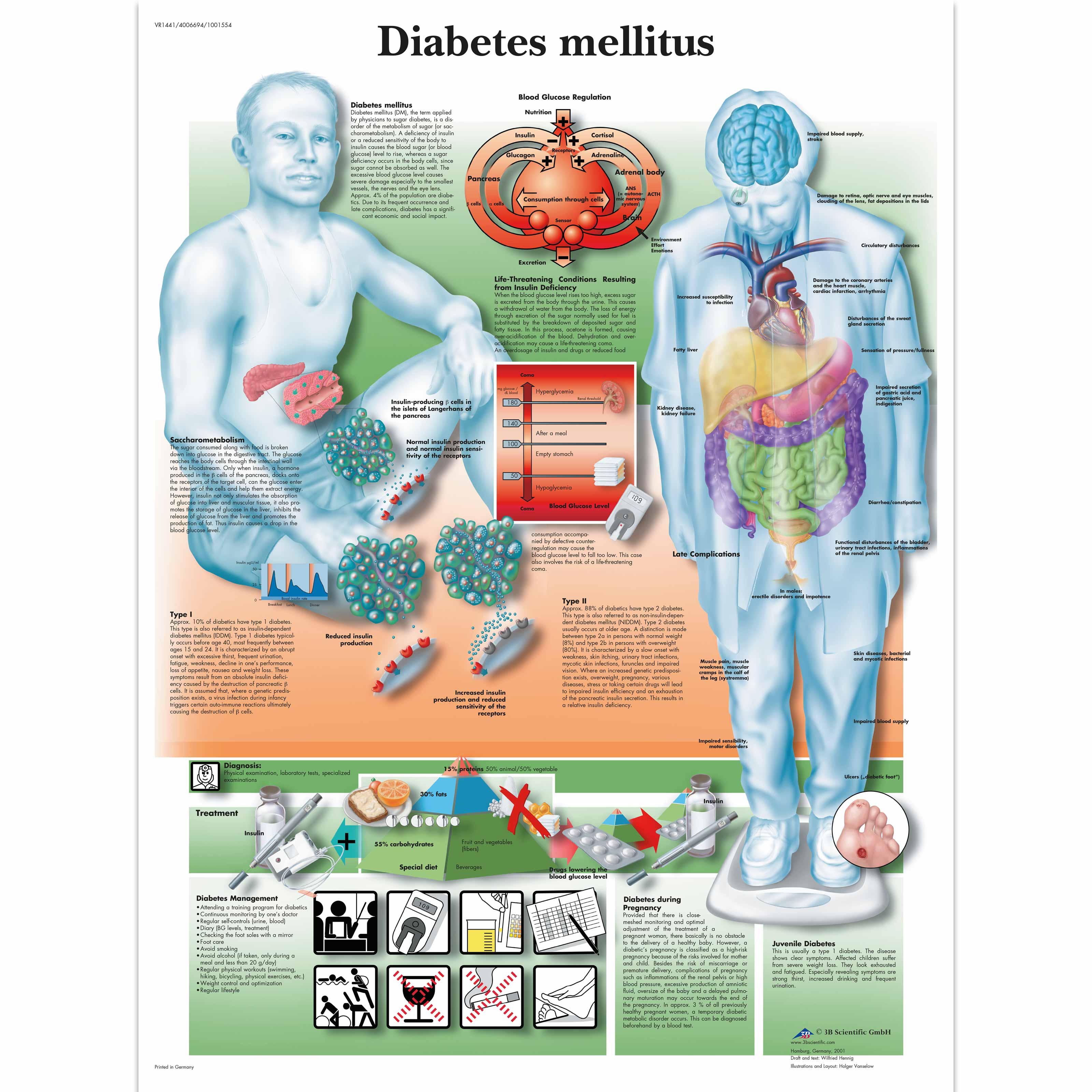 Diabetes Melitus Is