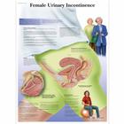 Female Urinary Incontinence Chart, 1001570 [VR1542L], Gynaecology