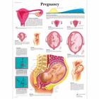 妊娠挂图, 1001572 [VR1554L], 怀孕与分娩