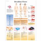 Decubitus Ulcers Chart, 1001606 [VR1717L], Skin