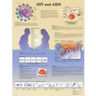 HIV和AIDS挂图, 1001610 [VR1725L], 性及药物教育
