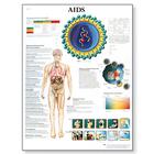 AIDS Chart, VR1727UU, Parasitic, Viral or Bacterial Infection