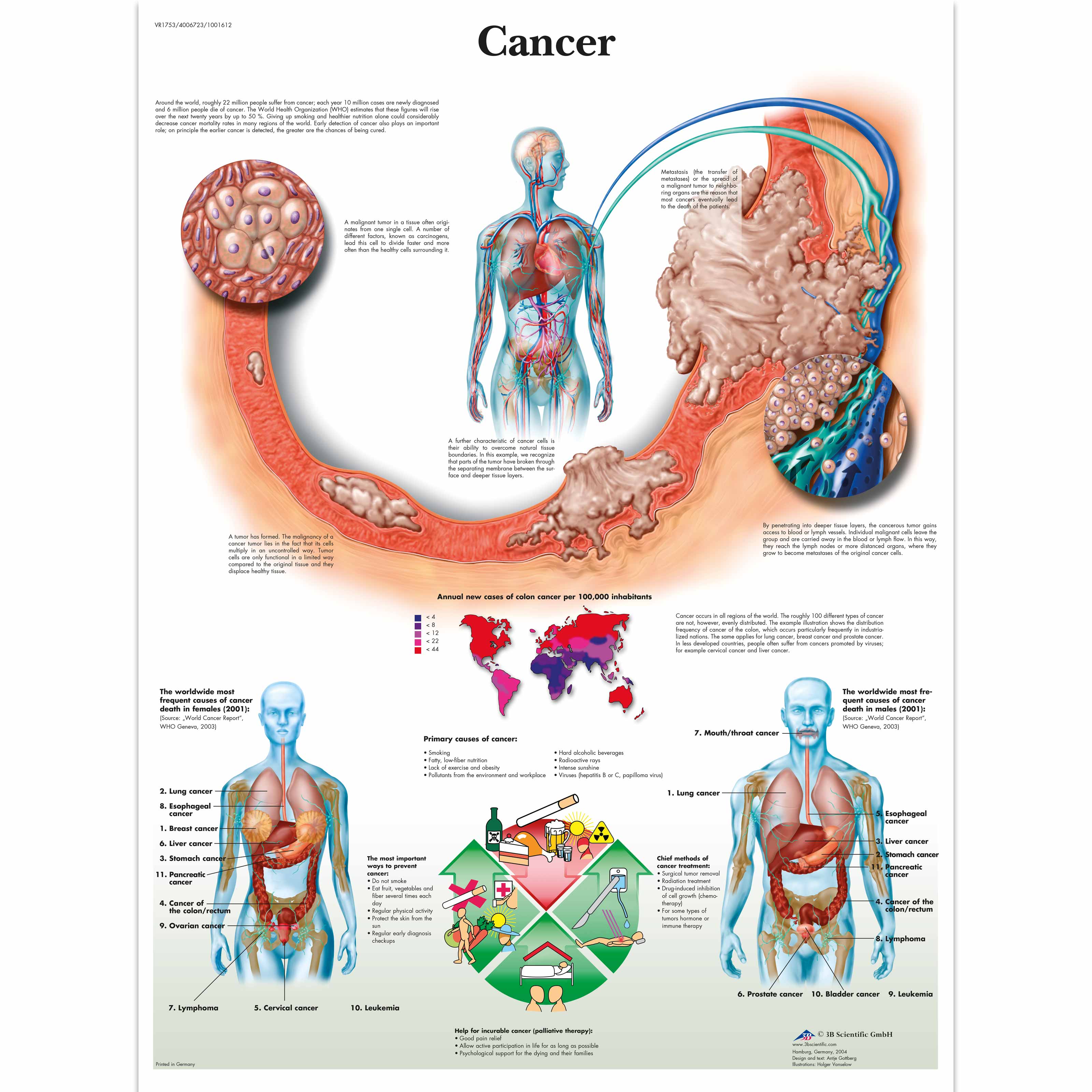 Anatomical Charts and Posters - Anatomy Charts - Pathology Charts