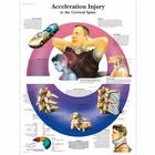 Lehrtafel - Acceleration Injury to the Cervical Spine, 4006724 [VR1761UU], Skelettsystem
