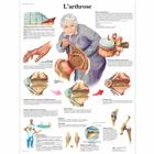 L'arthrose, 1001636 [VR2123L], Skeletal System