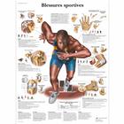 Blessures sportives, 1001658 [VR2188L], Muscle