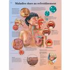 Maladies dues au refroidisement, 1001674 [VR2253L], Respiratory System
