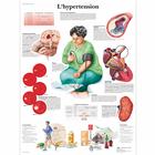 Lehrtafel - L'hypertension, 4006766 [VR2361UU], Herz-Kreislauf-System
